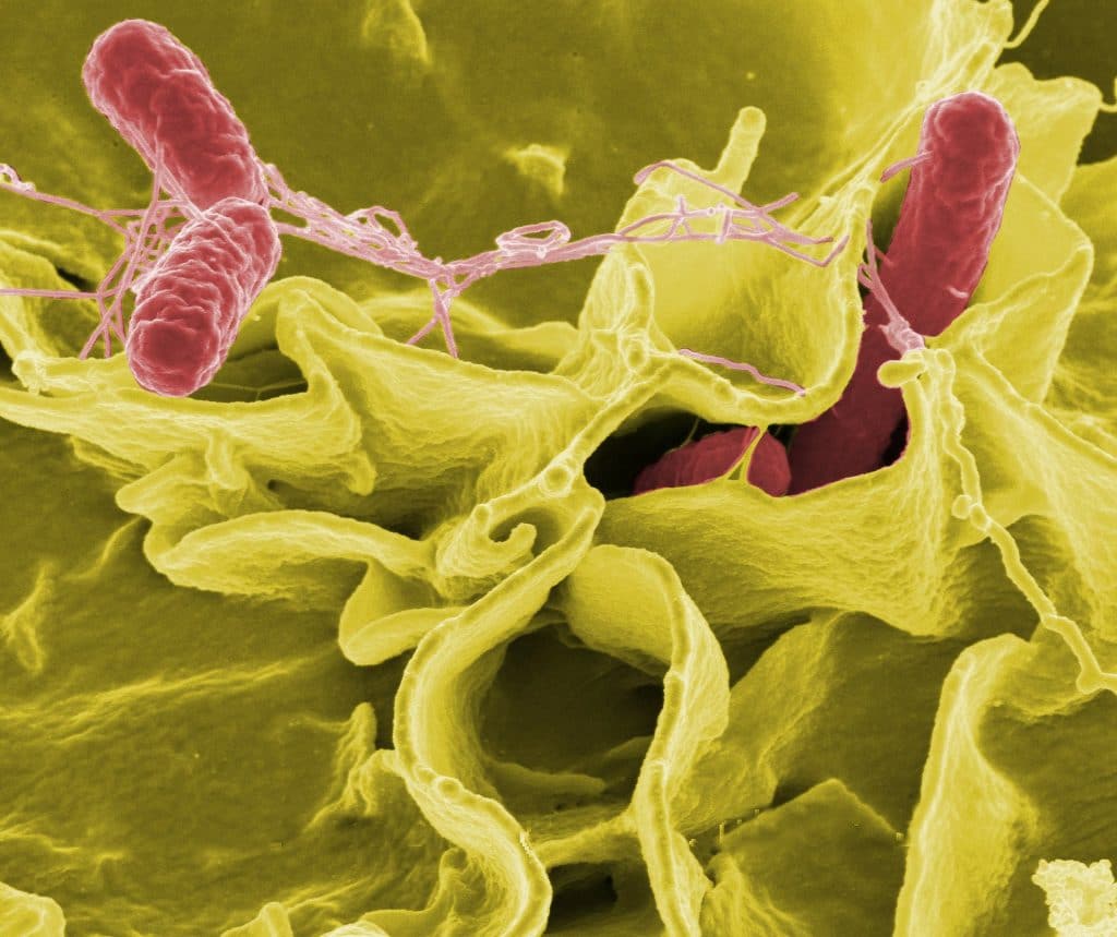 Legionella & E. Coli